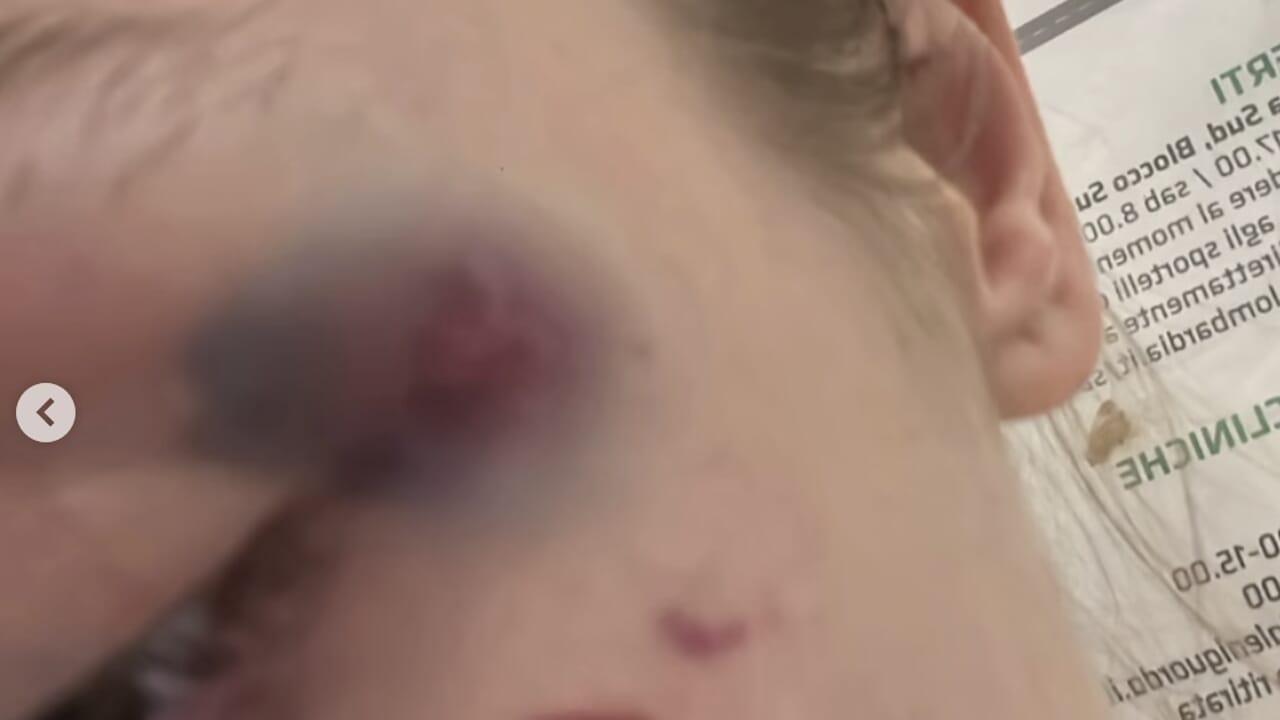 Il rapper Faneto ha picchiato la sua ex fidanzata, che ha raccontato tutto sui s...