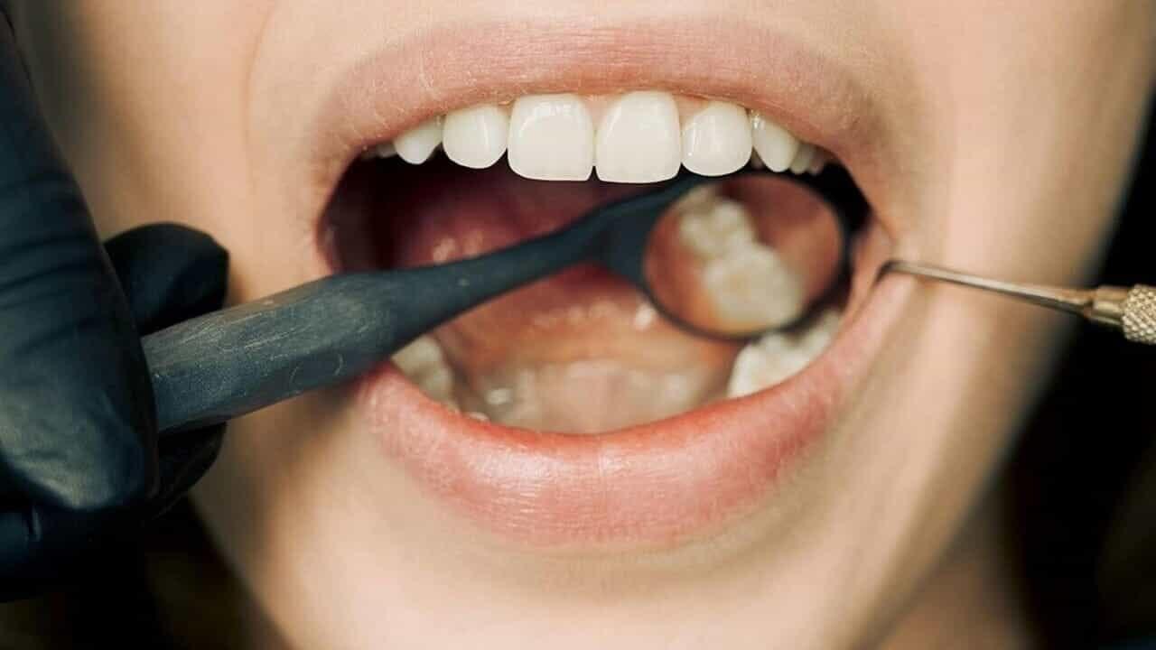 L’85% degli italiani ha problemi ai denti o ai denti: tutto dipende dalla prevenzione
